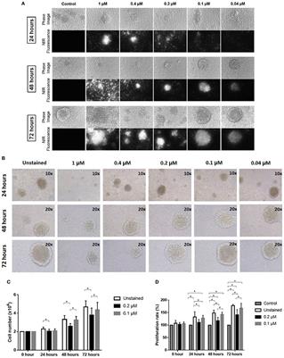 Real-Time Tracking of Ex Vivo-Expanded Natural Killer Cells Toward Human Triple-Negative Breast Cancers